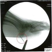 Röntgenbild: ohne Kommentar